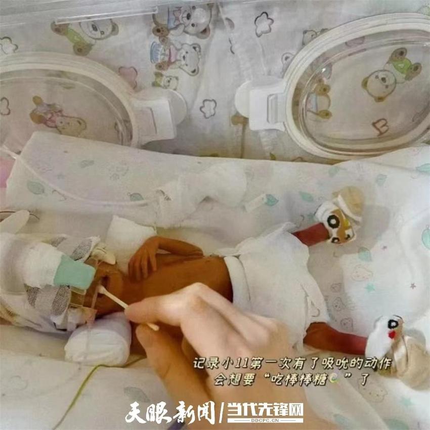 贵黔医院：650g婴儿成长记