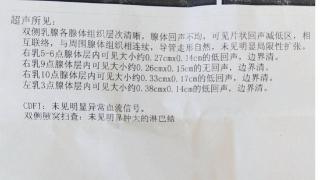 体胖，肝经不通！一张方子，养肝瘦身，请收藏