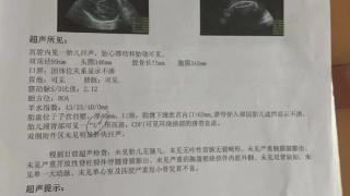 胎儿检出脐带缠绕数天后死亡，孕妇家属称医生风险评估不到位