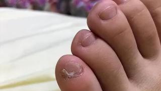 小脚趾指甲分成两瓣的人，到底是什么来历？你的指甲是这样吗？