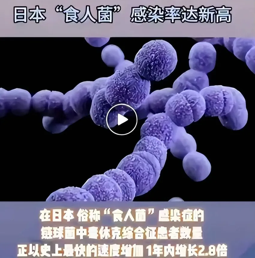 日本“食人菌”感染暴发，致死率超30%，飞沫就能传播