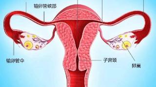 输卵管问题是不孕症最常见的病因之一，关于输卵管的几个常见问题