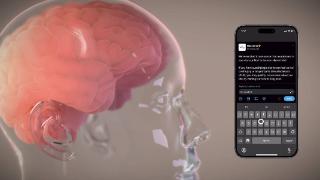 马斯克脑机接口公司neuralink开启患者登记计划