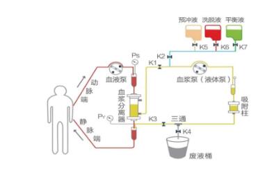 东北三省首例！吉大一院神经专科医院开展蛋白A免疫吸附治疗