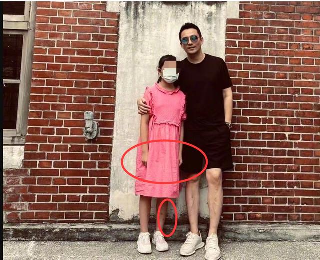 汪小菲晒孩子八年前后对比，合影里现光头男很讽刺，女儿腿上有疤