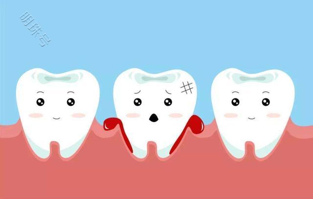 肝脏病变，牙齿先知？建议大家平时要多留意牙齿的3种情况