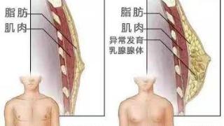 营养不良也是导致男性乳腺发育的重要因素