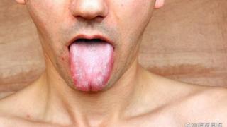 舌苔特别白厚的，嘴巴有味道的人看过来，一个中成药化解