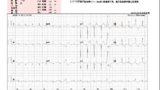 体检发现心电图异常，71岁的他庆幸躲过一劫