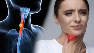 早期喉癌3大症状解析：声音嘶哑、异物感和咳嗽，了解下