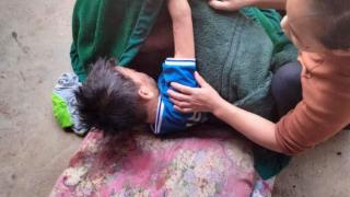 缅北腊戌12岁男孩误把手雷当玩具，4名儿童被炸伤
