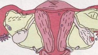 宫颈癌有哪“两个”早期症状
