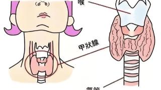 天草纲目：甲状腺癌逼近的5大前兆，你中了几个？快自查！别到晚期追悔莫及