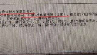 女演员被弄断肋骨，差点瘫痪！这事很多人下班就去做……