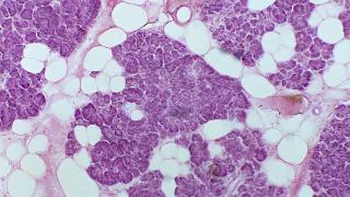 多发性内分泌肿瘤综合征Ⅰ型，累及哪些部位？主要的病因是什么？