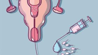 输卵管通水和子宫输卵管造影，两种检查方法到底有什么不同？