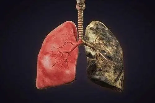 肺亮红灯，身体或会2处变黑，2处疼痛，若1个不占，保养得不错