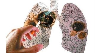 肺部有疾，身体往往伴有“2黑2黄1臭”