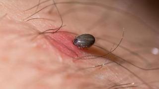 蜱虫叮咬严重可危及生命，春季出游如何防范