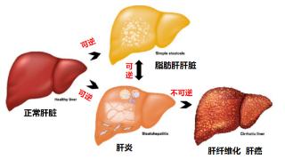 熬夜就是熬肝！LAIFE「乐轻肝」科技配方提升肝脏解毒能力