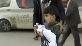 巴勒斯坦小男孩一言不发 紧抱空袭中丧生的弟弟