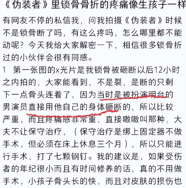 曝胡歌砸断王乐君锁骨，女方晒疤体内打七根钢钉，男方发文引热议