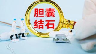 胆囊结石手术，对于切胆手术、保胆手术如何选择？参考下