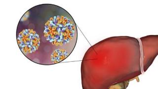 抽烟饮酒会直接“害了”肝脏，这2个症状就是肝病的信号