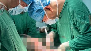 海医二院胸外科手术“移花接木” 让患者告别慢性脓胸