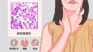 Castl病患者出现淋巴结显著肿大的症状，男女发病率是近似的