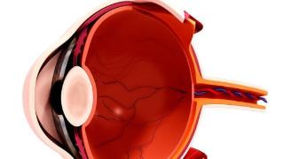 视盘水肿常见的病因有哪些？科普下
