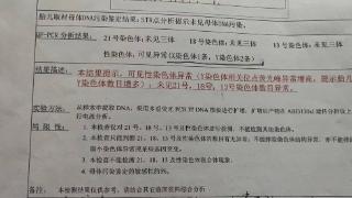 孕妇被指责怀“天生杀人犯” 决定引产