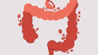 溃疡性结肠炎，根本问题可能在肝