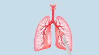 肺结核好转的身体表现有哪些