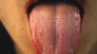 舌头哪些表现，是身体的求救信号