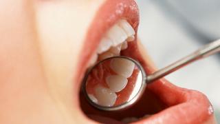 口腔溃疡反反复复，是哪4种原因造成的