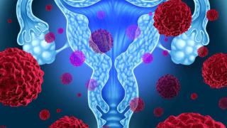 提醒女性：身体一旦出现这4大异常，需及时对宫颈肿瘤进行筛查！