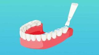 美牙仪让牙齿变白的原理是什么