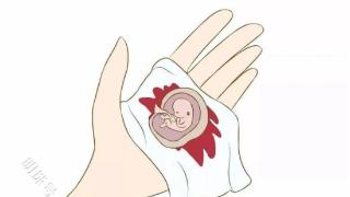 真孕囊、假孕囊与空孕囊，这三种不同的情况