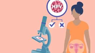 下沙哪里治疗HPV比较好？哪些人群容易感染hpv？