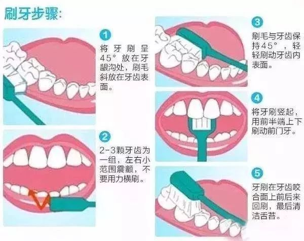 @贵阳家长，如何守护孩子牙齿健康？有30余年治疗经验的牙科专家说……