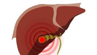 胆囊出现病变要切除？提醒：人没了“胆”，当心身体出现3大异常