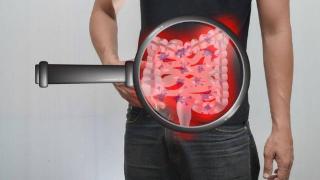 你了解“肠结核”？它和其他肠胃疾病有何区别？一文带你了解它！