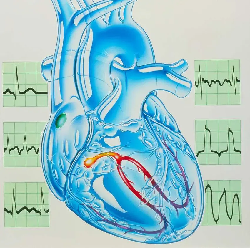 心脏造影或者心脏增强CT之前要排除以下4种情况，有致命风险