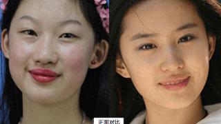 19岁少女执意整成“刘亦菲”，连名字也高仿，现在8年过去了，她现状怎样？
