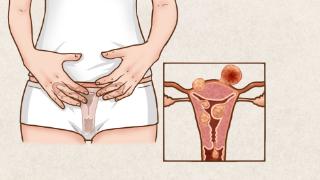 子宫出了问题，会有哪些症状表现？